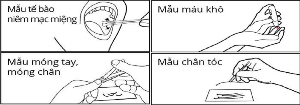 Xét nghiệm ADN huyết thống, Xét nghiệm ADN huyết thống